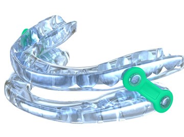 Close-up of an oral appliance used to treat sleep apnea in The Woodlands, TX
