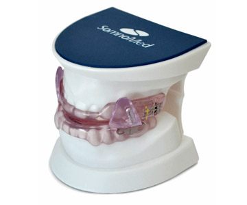 SomnoMed oral appliance