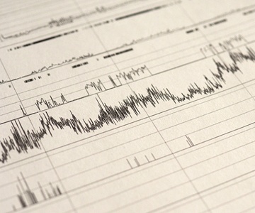 The results of a home sleep study for sleep apnea