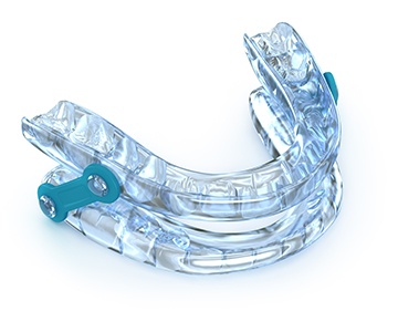 an oral appliance used for sleep apnea treatment  
