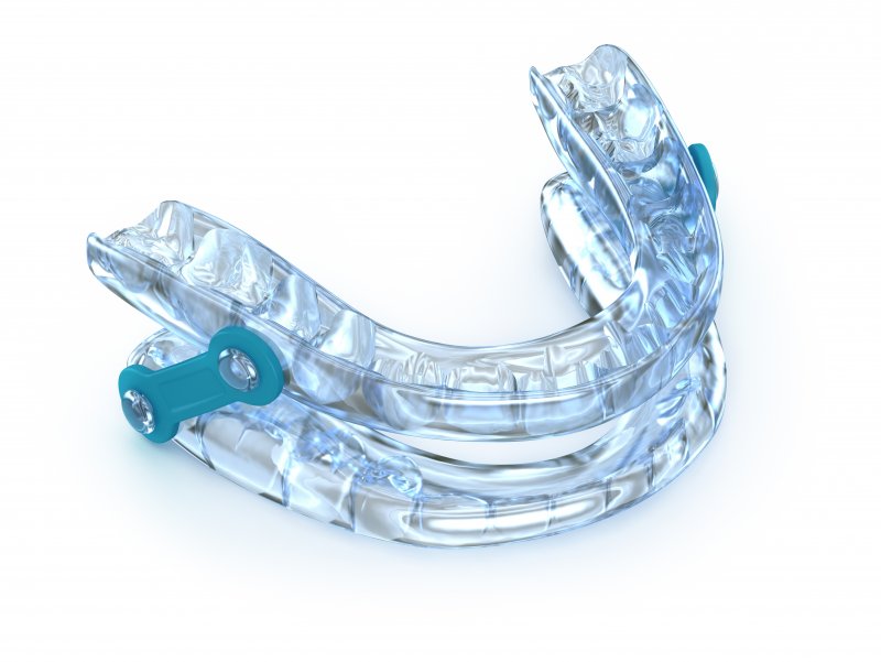 A closeup of an oral appliance that treats sleep apnea